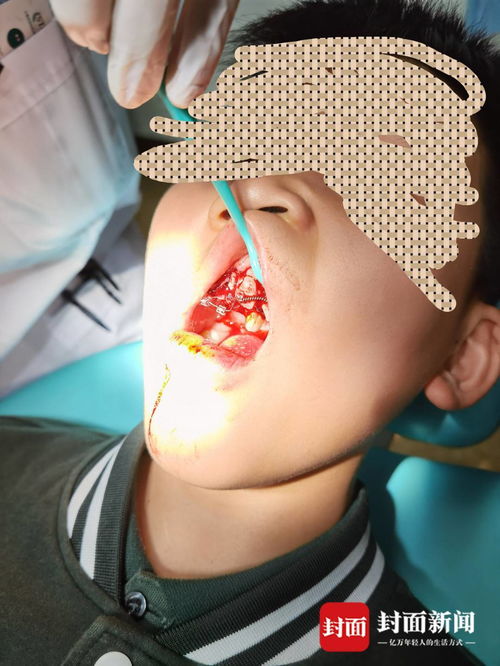 重庆特斯拉车主遭遇惊魂一幕 停车时车辆自动加速撞墙，致孩子受伤